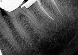 16apr7bcsimmons03 16apr7bcsimmons03