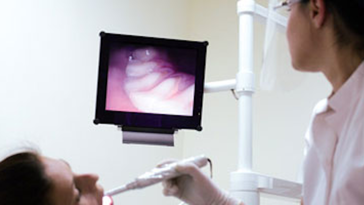 Content Dam Diq Online Articles 2016 04 Intraoral Camera 1