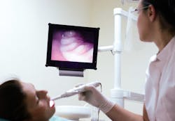 Intraoral Camera Intraoral Camera