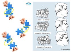 Occlusionmsh Occlusionmsh