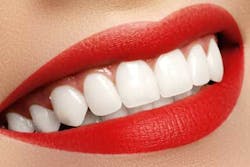 Whitesmidreamstime Whitesmidreamstime