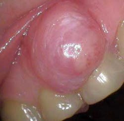 16jun2bcsimmons02 Pathcase16 16jun2bcsimmons02 Pathcase16