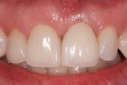 16may5bcmeek Impressions16 16may5bcmeek Impressions16