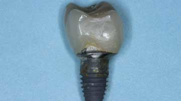 Content Dam Diq Online Articles 2016 05 16may5bcedn Simmonst