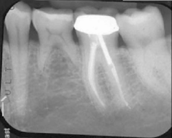 Sterio Gbr P01 Sterio Gbr P01