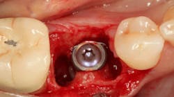 Sterio Gbr P02 Sterio Gbr P02