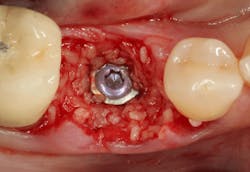 Sterio Gbr P03 Sterio Gbr P03