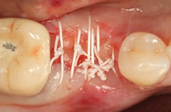 Sterio Gbr P05 Sterio Gbr P05