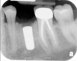 Sterio Gbr P06 Sterio Gbr P06