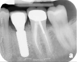 Sterio Gbr P07 Sterio Gbr P07