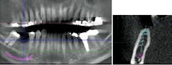 Sterio Gbr P10 Sterio Gbr P10