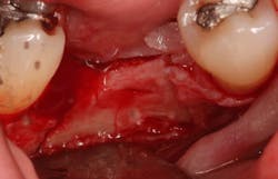 Sterio Gbr P12 Sterio Gbr P12