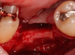 Sterio Gbr P13 Sterio Gbr P13