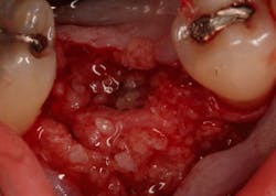 Sterio Gbr P15 Sterio Gbr P15