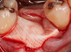 Sterio Gbr P16 Sterio Gbr P16