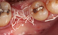 Sterio Gbr P17 Sterio Gbr P17