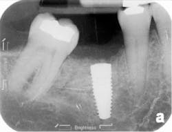 Sterio Gbr P18 Sterio Gbr P18