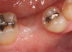 Sterio Gbr P19 Sterio Gbr P19