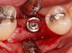 Sterio Gbr P20 Sterio Gbr P20