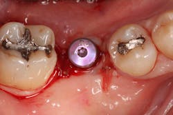 Sterio Gbr P21 Sterio Gbr P21