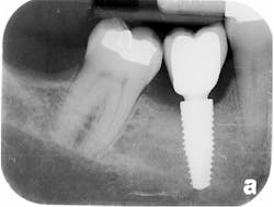 Sterio Gbr P22 Sterio Gbr P22