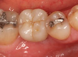 Sterio Gbr P23 Sterio Gbr P23