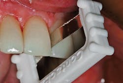 Contacez Acp Fig2 Contacez Acp Fig2