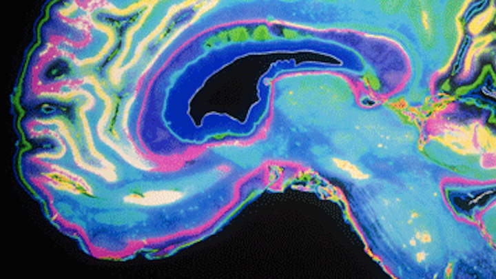 Content Dam Diq Online Articles 2016 06 Brain Scan Thumb
