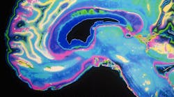 Content Dam Diq Online Articles 2016 06 Brain Scan Thumb Content Dam Diq Online Articles 2016 06 Brain Scan Thumb