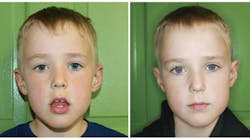 Content Dam Diq Online Articles 2016 06 Oral Rest Posture Thumb Content Dam Diq Online Articles 2016 06 Oral Rest Posture Thumb