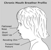 Mouth Breather Mouth Breather