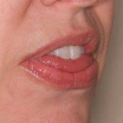 16jul7bchodges06 16jul7bchodges06