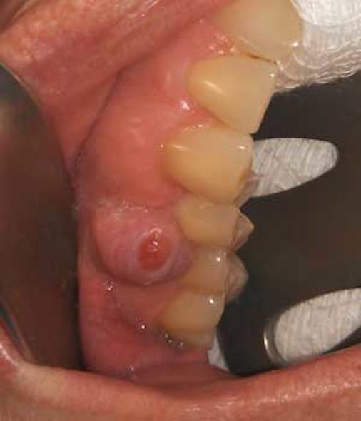 16jul7bcsimmons Diagtx16pathcase01