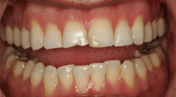 Content Dam Diq Online Articles 2016 07 Mackey Quickfix Diqthumb