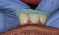 Mackey Quickfix Fig04 Mackey Quickfix Fig04