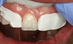 Mackey Quickfix Fig05 Mackey Quickfix Fig05