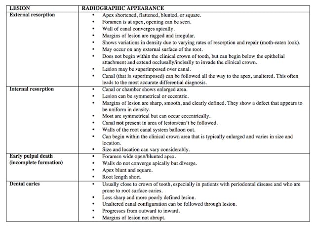 Endodontics reference guide: Distinguishing differences between internal  and external resorption