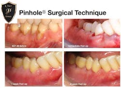 16aug4bcbeck01 16aug4bcbeck01