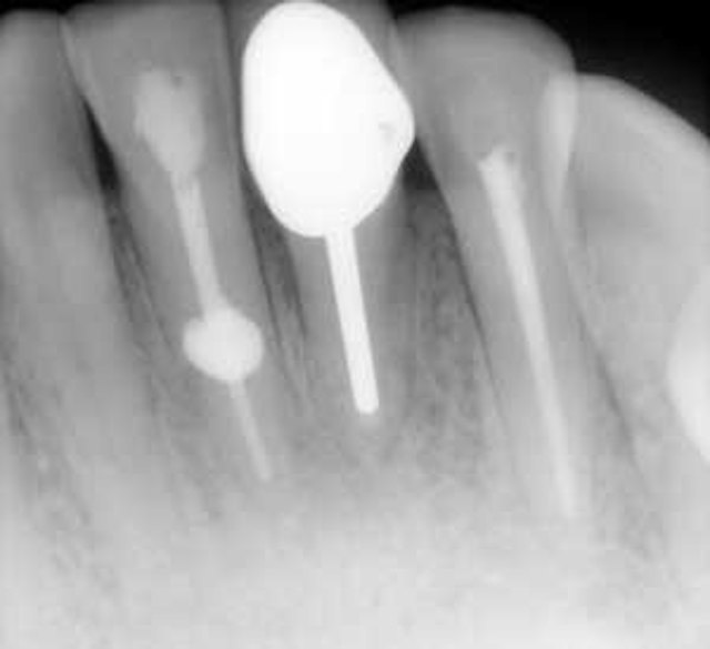 Endodontics reference guide Distinguishing differences between
