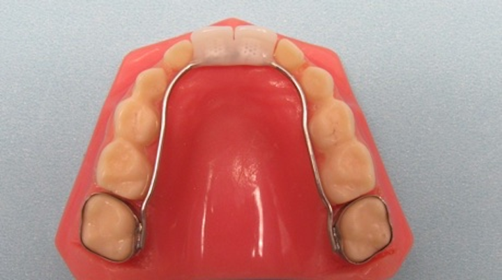 How Can Dental Professionals Tell The Difference Between Real And Impostor Groper Pedo Partials Dentistryiq