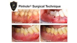 Content Dam Diq Online Articles 2016 08 16aug4bcbeckt Content Dam Diq Online Articles 2016 08 16aug4bcbeckt