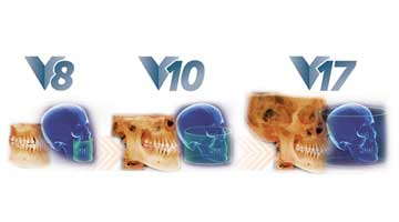 Content Dam Diq Online Articles 2016 08 16aug4bci Cat T