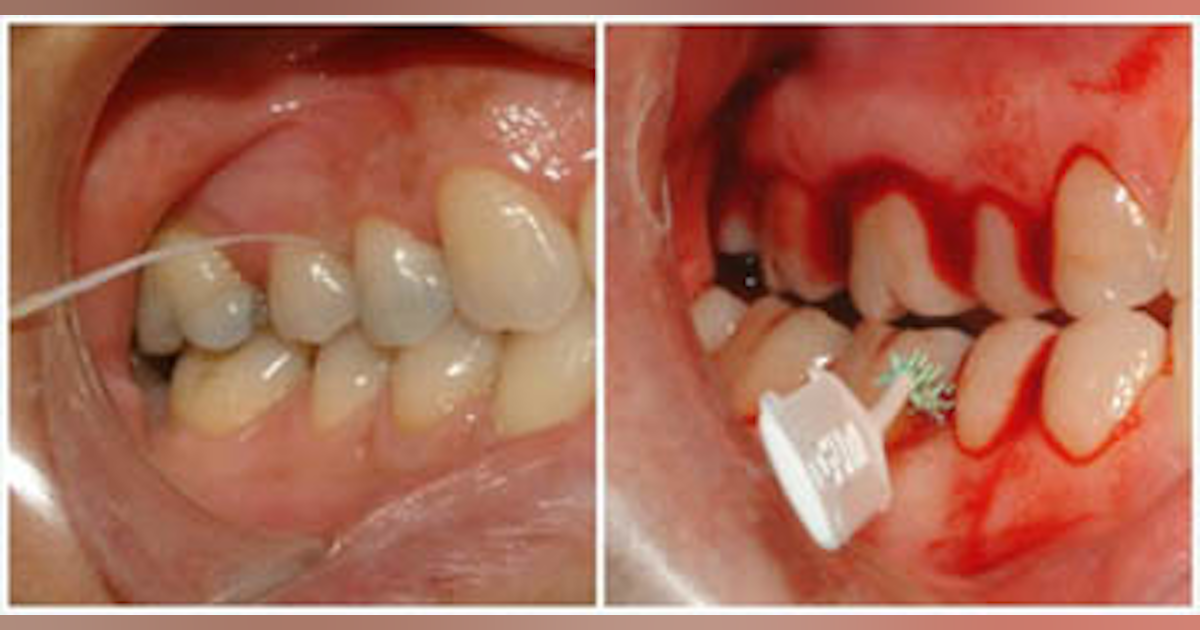 A new 'flossophy' exposes the myths surrounding the efficacy of