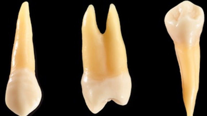 Content Dam Diq Online Articles 2016 08 Tooth Root Thumb