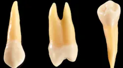 Content Dam Diq Online Articles 2016 08 Tooth Root Thumb