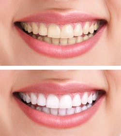 Hodsdonwhitening Hodsdonwhitening