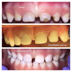 Hua Ezpedo Case1 01 Hua Ezpedo Case1 01