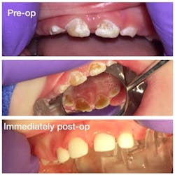 Hua Ezpedo Case3 Hua Ezpedo Case3