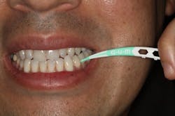 Pmm Softpicksadvanced Fig03 Pmm Softpicksadvanced Fig03