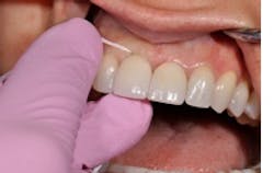 Vigerflossleftmsh Vigerflossleftmsh